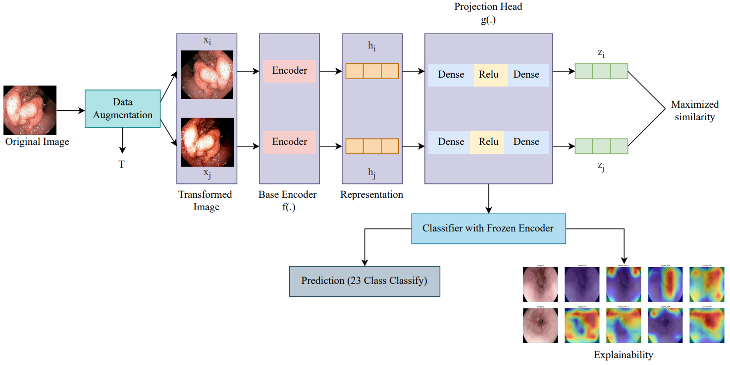 Gastrointestinal Disease Classification through Explainable and Cost-Sensitive Deep Neural Networks with Supervised Contrastive Learning